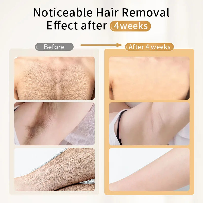 Moolweel T001 Professional Home Use IPL Laser Hair Removal Machine Painless Sapphire Cooling Features Handheld Electric Epilator
