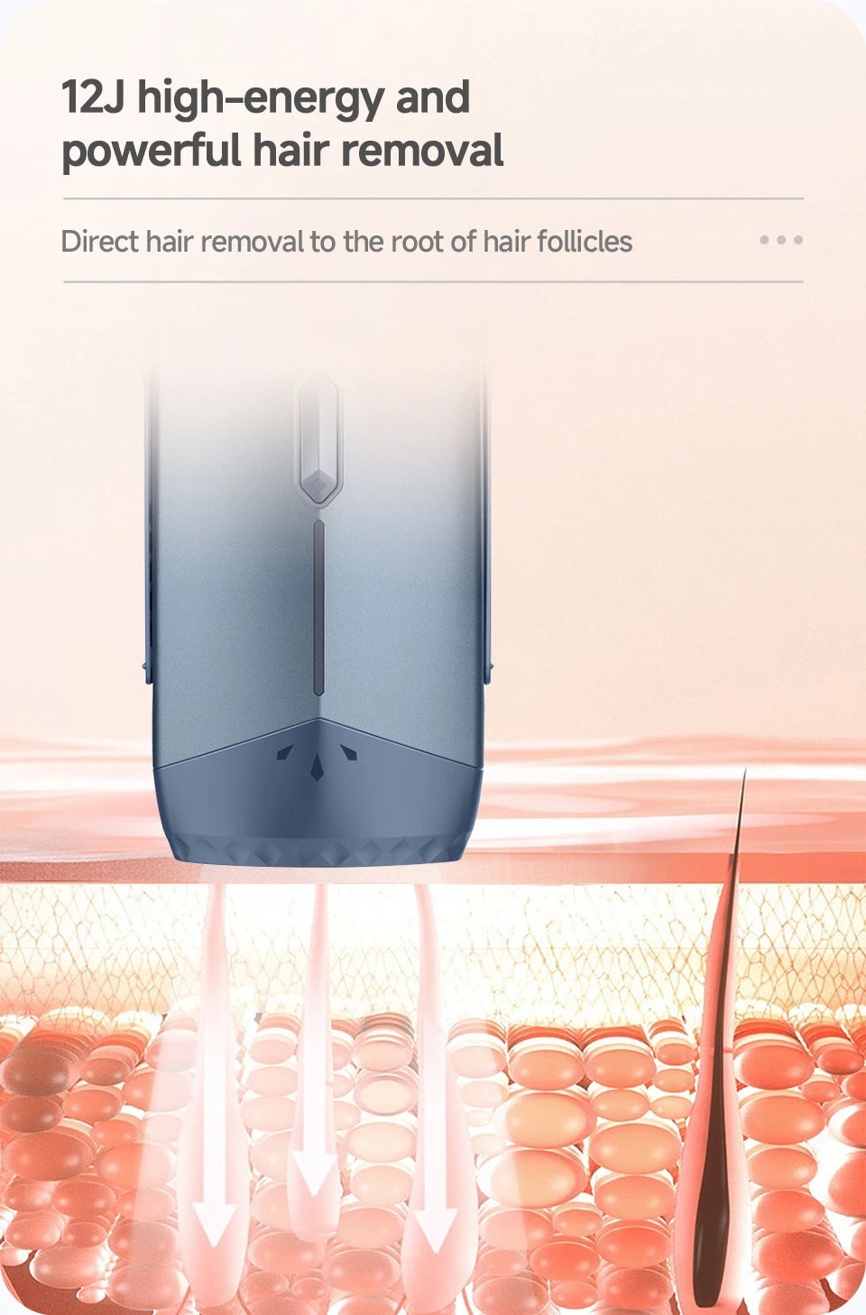 IPL Laser Hair Removal