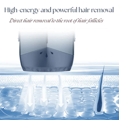 MLAY T18 IPL Hair Removal Device